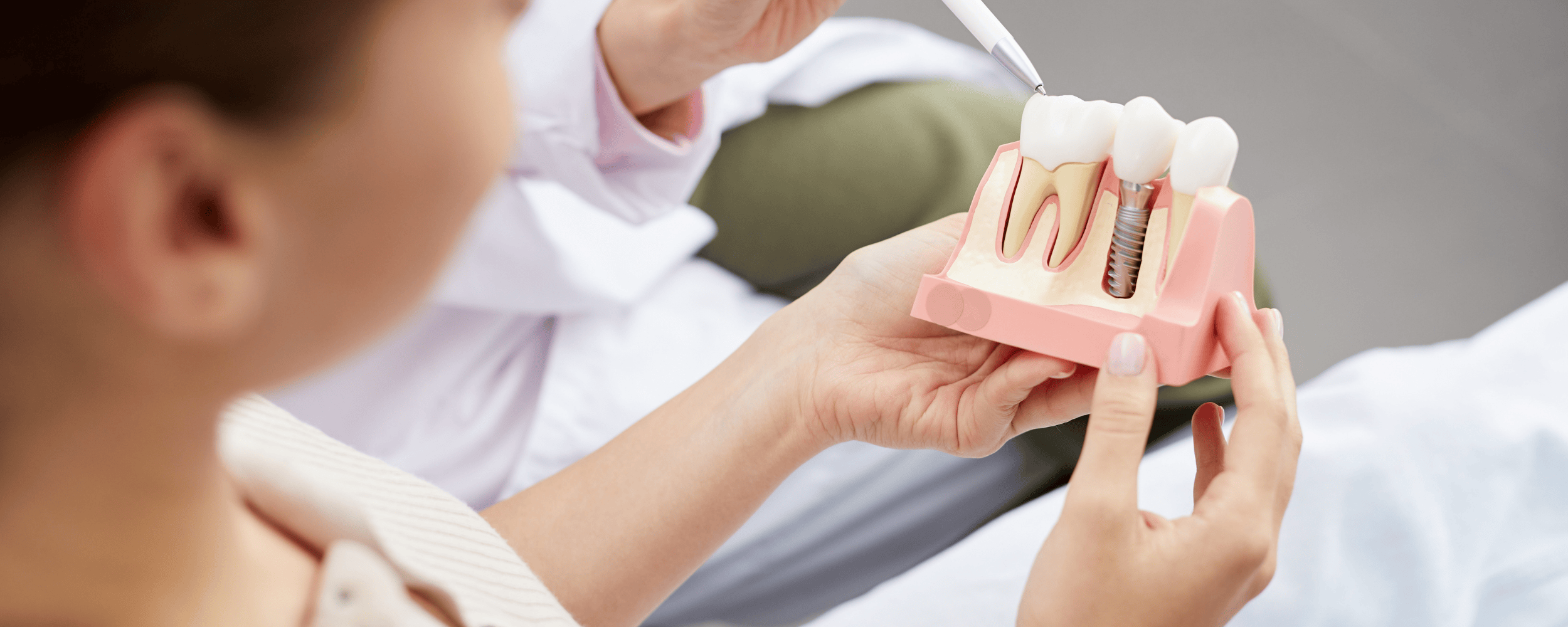 Permanent, Natural-Looking Tooth Replacement with Implants